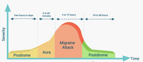 How does food affect your Migraine? - MedExpress